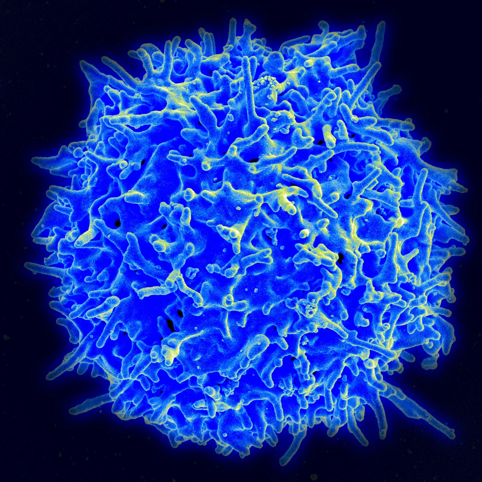 Colorized scanning electron micrograph of a human T lymphocyte from a healthy donor